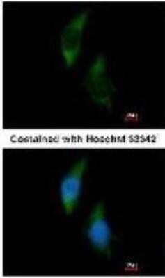 Immunocytochemistry/ Immunofluorescence: FARSLA Antibody [NBP1-33308]