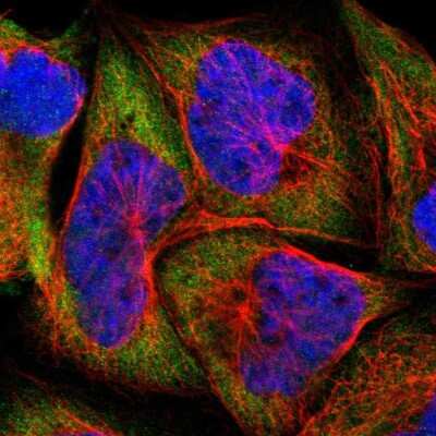 Immunocytochemistry/ Immunofluorescence: FARSLA Antibody [NBP1-88067]