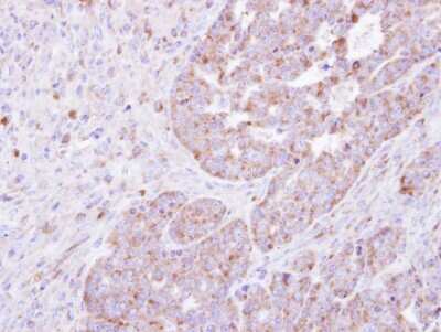 Immunohistochemistry-Paraffin: FARSLA Antibody [NBP1-33308]