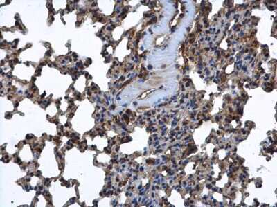 Immunohistochemistry-Paraffin: FARSLA Antibody [NBP1-33308]