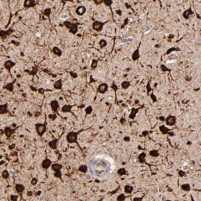 Immunohistochemistry-Paraffin: FARSLA Antibody [NBP1-88067]