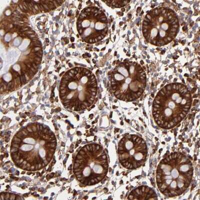 Immunohistochemistry-Paraffin: FARSLA Antibody [NBP1-88067]