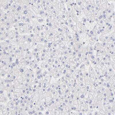 Immunohistochemistry-Paraffin: FARSLA Antibody [NBP1-88067]