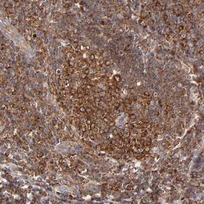 Immunohistochemistry-Paraffin: FARSLA Antibody [NBP1-88067]