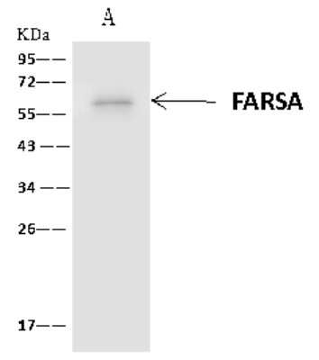 Immunoprecipitation: FARSLA Antibody [NBP2-97761]