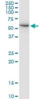 Western Blot: FARSLA Antibody [H00002193-B01P]