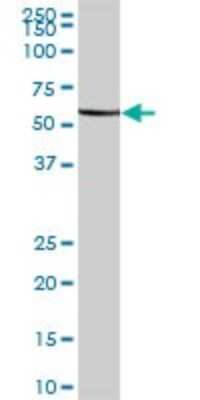 Western Blot: FARSLA Antibody [H00002193-B01P]
