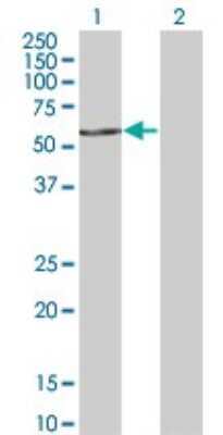 Western Blot: FASTK Antibody (2B7) [H00010922-M02]