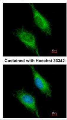 Immunocytochemistry/ Immunofluorescence: FASTK Antibody [NBP1-31323]
