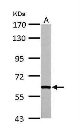 Western Blot: FASTK Antibody [NBP1-31323]
