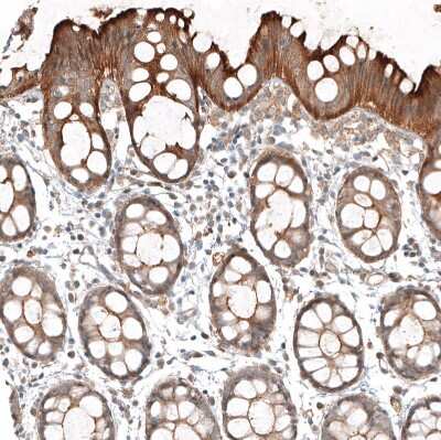 Immunohistochemistry-Paraffin: FAT1 Antibody [NBP1-84565]