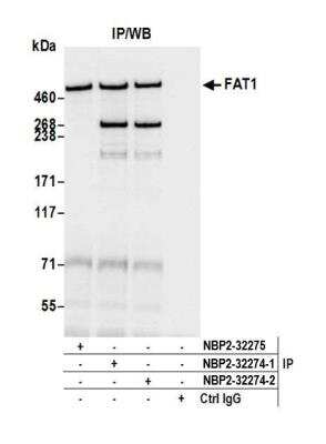 Immunoprecipitation: FAT1 Antibody [NBP2-32274]