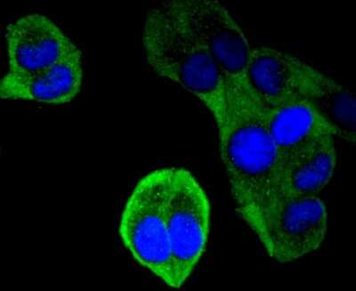 Immunocytochemistry/ Immunofluorescence: FAT10 Antibody (JJ084-09) [NBP2-67917]