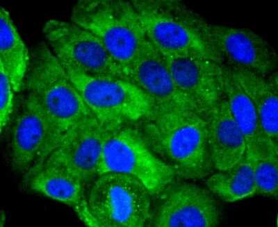 Immunocytochemistry/ Immunofluorescence: FAT10 Antibody (JJ084-09) [NBP2-67917]