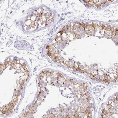 Immunohistochemistry-Paraffin: FATE1 Antibody [NBP1-85402]