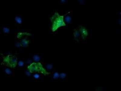 Immunocytochemistry/ Immunofluorescence: FATE1 Antibody (OTI1A1) - Azide and BSA Free [NBP2-72310]