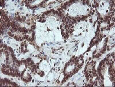Immunohistochemistry: FATE1 Antibody (OTI1A1) - Azide and BSA Free [NBP2-72310]