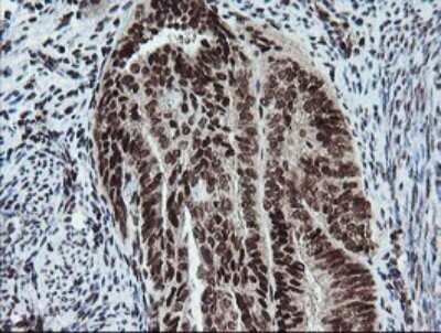 Immunohistochemistry: FATE1 Antibody (OTI1A1) - Azide and BSA Free [NBP2-72310]