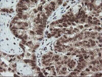 Immunohistochemistry: FATE1 Antibody (OTI1A1) - Azide and BSA Free [NBP2-72310]