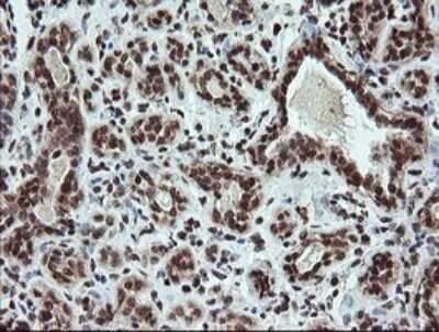 Immunohistochemistry: FATE1 Antibody (OTI1A1) - Azide and BSA Free [NBP2-72310]