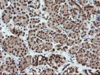 Immunohistochemistry: FATE1 Antibody (OTI1A1) - Azide and BSA Free [NBP2-72310]