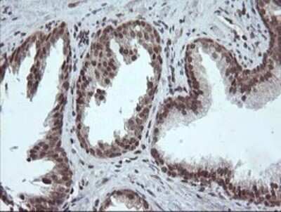 Immunohistochemistry: FATE1 Antibody (OTI1A1) - Azide and BSA Free [NBP2-72310]