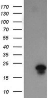 Western Blot: FATE1 Antibody (OTI1A1)Azide and BSA Free [NBP2-72310]
