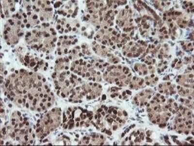 Immunohistochemistry: FATE1 Antibody (OTI1A1) [NBP2-45594]