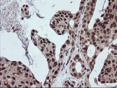 Immunohistochemistry: FATE1 Antibody (OTI1A1) [NBP2-45594]