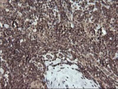 Immunohistochemistry: FATE1 Antibody (OTI1A1) [NBP2-45594]
