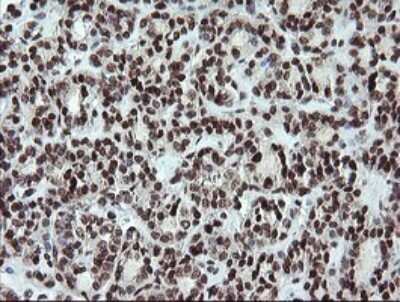 Immunohistochemistry: FATE1 Antibody (OTI1A1) [NBP2-45594]