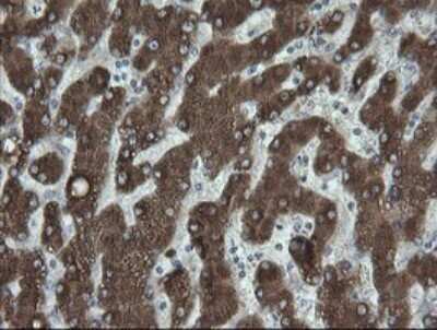 Immunohistochemistry: FATE1 Antibody (OTI1A1) [NBP2-45594]
