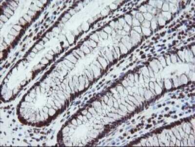 Immunohistochemistry: FATE1 Antibody (OTI1A1) [NBP2-45594]