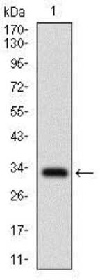 Western Blot: FATP2/SLC27A2 Antibody (6B3A9)BSA Free [NBP2-37738]