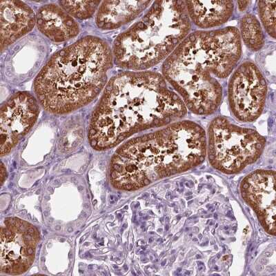 Immunohistochemistry-Paraffin: FATP2/SLC27A2 Antibody [NBP3-05516]