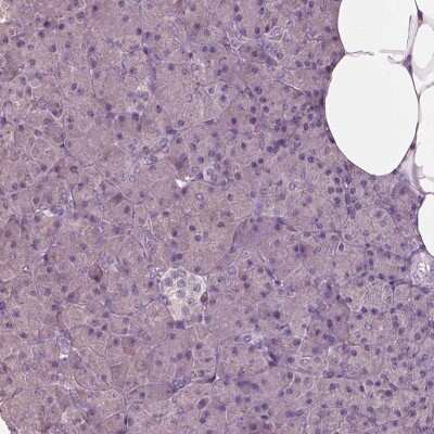 Immunohistochemistry-Paraffin: FATP2/SLC27A2 Antibody [NBP3-05516]