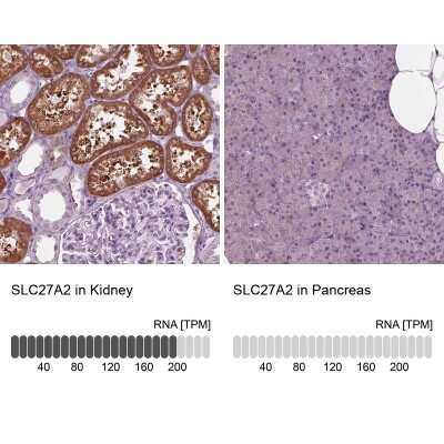 Immunohistochemistry-Paraffin: FATP2/SLC27A2 Antibody [NBP3-05516]