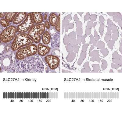 Immunohistochemistry-Paraffin: FATP2/SLC27A2 Antibody [NBP3-05516]