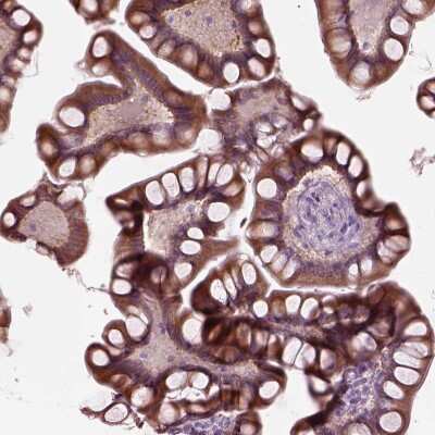 Immunohistochemistry-Paraffin: FATP2/SLC27A2 Antibody [NBP3-05516]