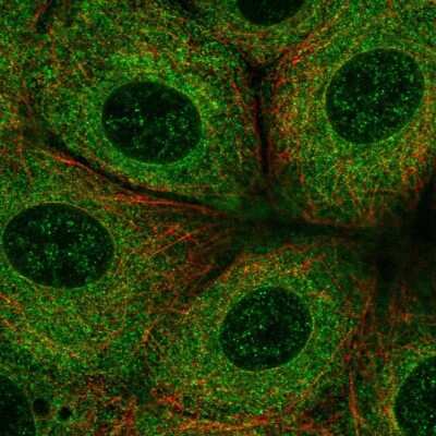 Immunocytochemistry/ Immunofluorescence: FATP3/SLC27A3 Antibody [NBP1-89265]