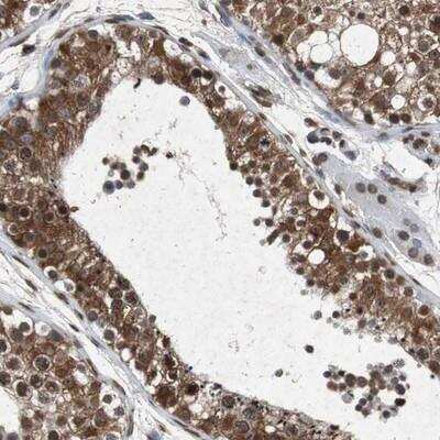 Immunohistochemistry-Paraffin: FATP3/SLC27A3 Antibody [NBP1-89265]