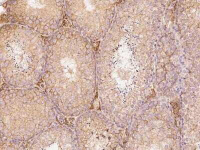 Immunohistochemistry-Paraffin: FATP3/SLC27A3 Antibody [NBP2-99424]