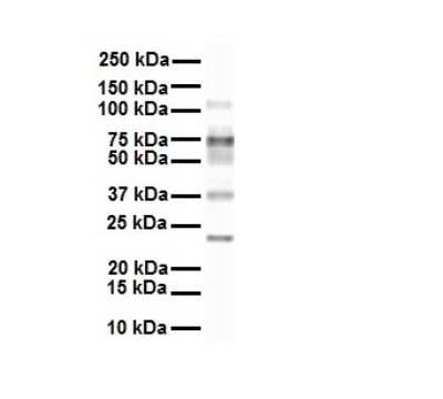 Western Blot: FATP3/SLC27A3 Antibody [NBP1-59839]