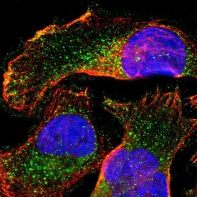 Immunocytochemistry/ Immunofluorescence: FATP4/SLC27A4 Antibody [NBP3-05510]