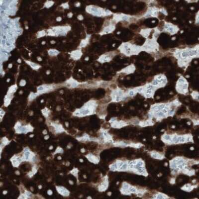Immunohistochemistry-Paraffin: FATP5/SLC27A5 Antibody (CL0215) [NBP2-52880]