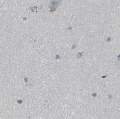 Immunohistochemistry-Paraffin: FBF1 Antibody [NBP1-90863]