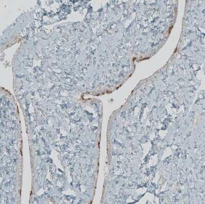 Immunohistochemistry-Paraffin: FBF1 Antibody [NBP1-90863]