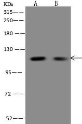 Western Blot: FBF1 Antibody [NBP3-12618]