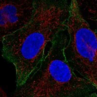 Immunocytochemistry/ Immunofluorescence: FBP2 Antibody [NBP3-17033]