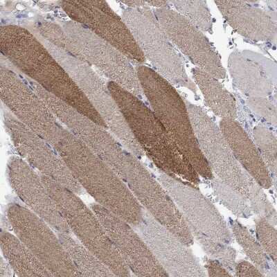 Immunohistochemistry-Paraffin: FBP2 Antibody [NBP3-17033]